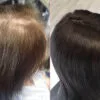 Hair-Loss-Integration-Training-3.jpg